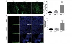 富氢水抑制TGF-β1/α-SMA/Col1α1通路调控内质网应激改善肺纤维化小鼠肺损伤